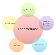 A l’occasion de la journée mondiale contre l’endométriose, l ... Image 1