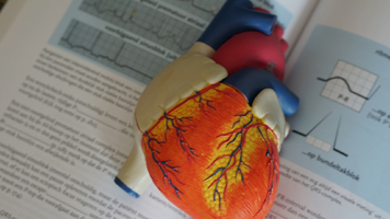 Formation Électrocardiogramme (ECG) Image 1