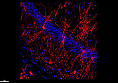 Meilleure compréhension de la maladie d’Alzheimer : une étud ... Image 1