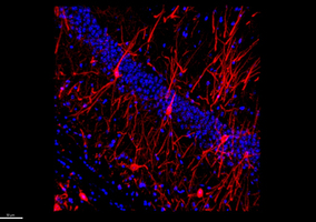 Meilleure compréhension de la maladie d’Alzheimer : une étud ... Image 1