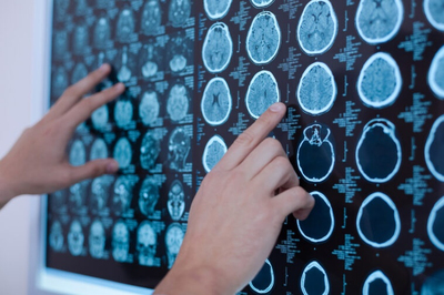 Des chercheurs font une percée dans la détection du cancer d ... Image 1