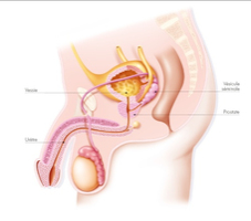 Une IA révolutionnaire pour détecter les cancers de la prost ... Image 1