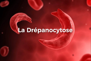 Drépanocytose : tous les nouveau-nés seront dépistés pour la ... Image 1