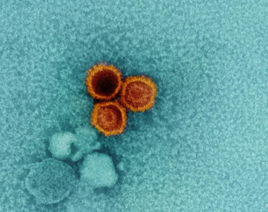 Ce virus infecte 95 % d’entre nous et ses points faibles ont ... Image 1