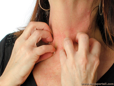 Anaphylaxie sévère en France : qui sont les sujets à risque  ... Image 1