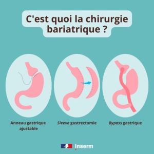 Journée mondiale contre l'obésité : que penser des nouveaux  ... Image 1