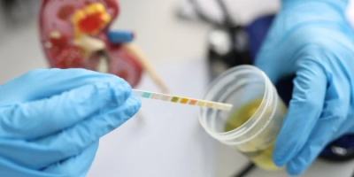 Les Américains mettent au point un test urinaire capable de  ... Image 1