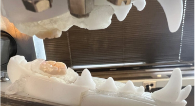 Des chercheurs développent un chewing-gum antiviral pour com ... Image 1