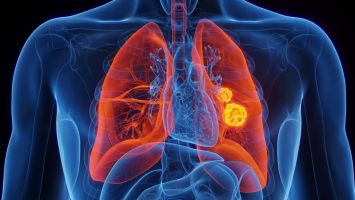 Cancer : une nouvelle molécule pour lutter contre les métast ... Image 1